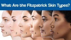 What Are the Fitzpatrick Skin Types