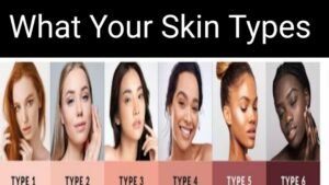 What Are the Fitzpatrick Skin Types