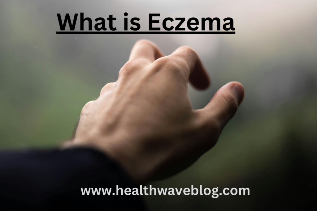 What is Eczema , Symptoms, Causes and / 4 easy tips for Treatment