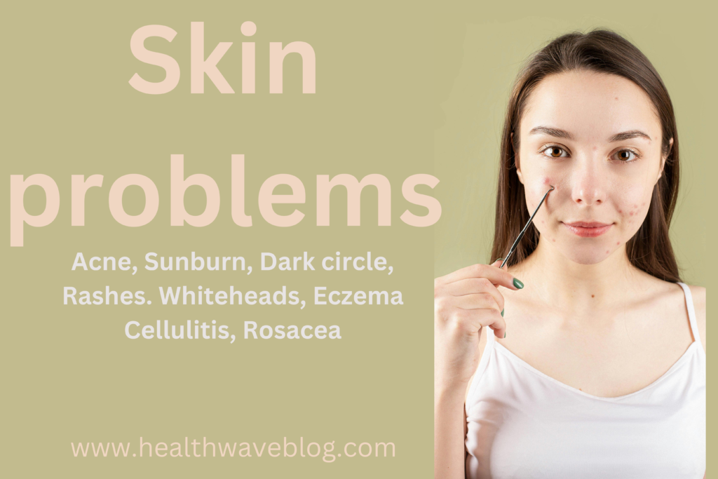 10 Powerful Tips to Tackle the Top Skin Problems: From Acne to Shingles