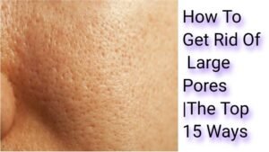 How To Get Rid Of Large Pores |The Top 15 Ways