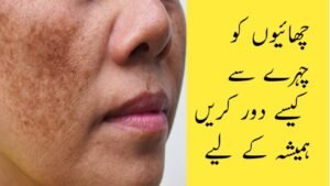 How To remove Pigmentation|From Face permanently| Top 15 Home remedies