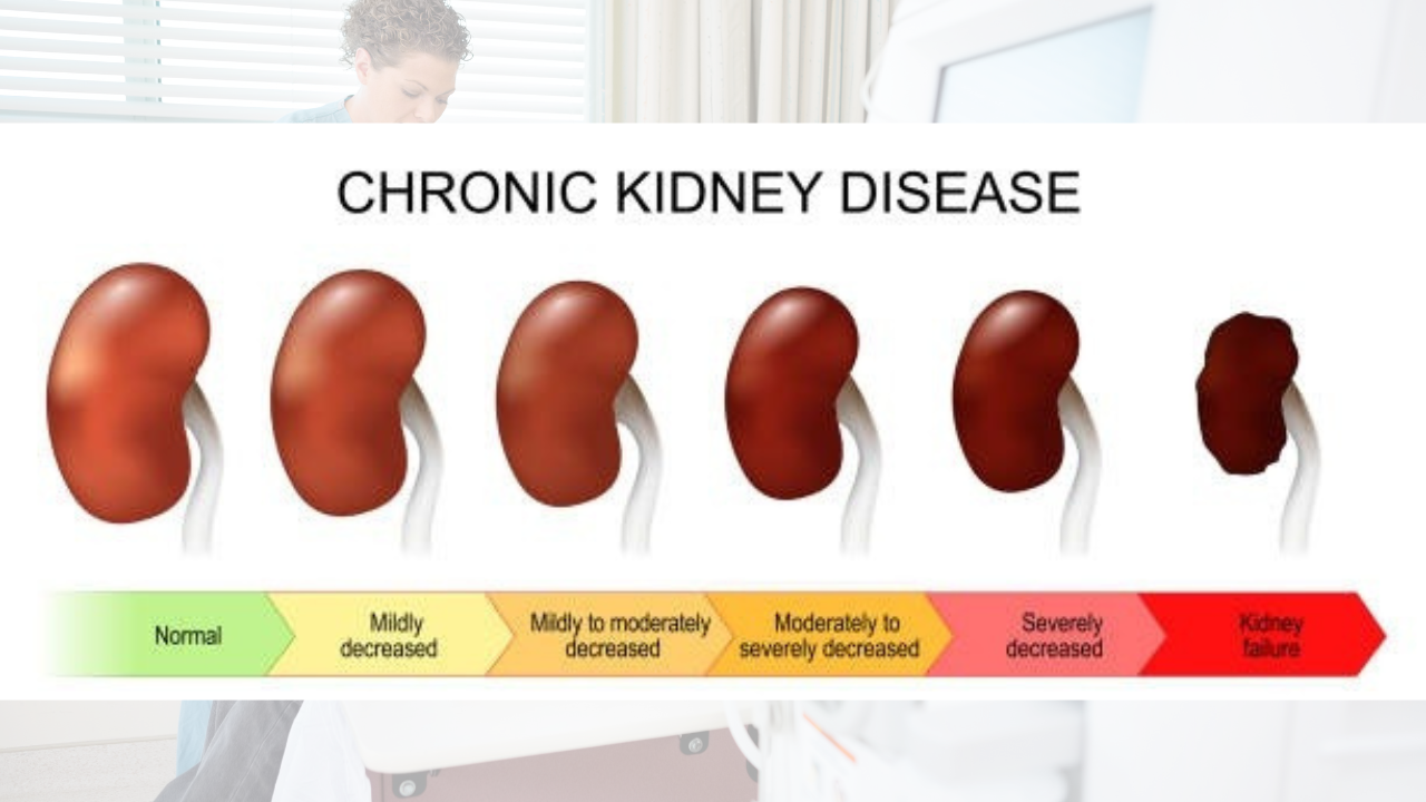 Chronic Kidney Disease | Credit: Rocky Mount